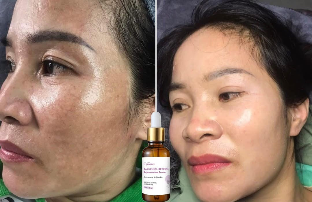 Venature Bakuchiol Retinol Rejuvenation Serum -30ml