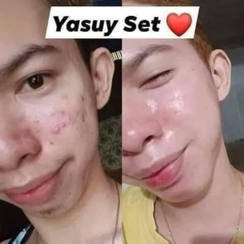 Yasuy Skin Rejuvenating set (new pack) - Shop Essential Skin Care Products online | Natural Organic skin care products | ROSYSKIN ESSENTIALS LLC