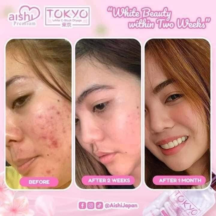 Aishi- TOKYO White | Block Dfyage | Glutathione 60caaps