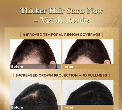 LUMÉI Rosemary Infused Hair Growth Support Serum Caffeine Glycerin Diaminopy-rimidine oxide Advanced Root Renewal Formula 30ml