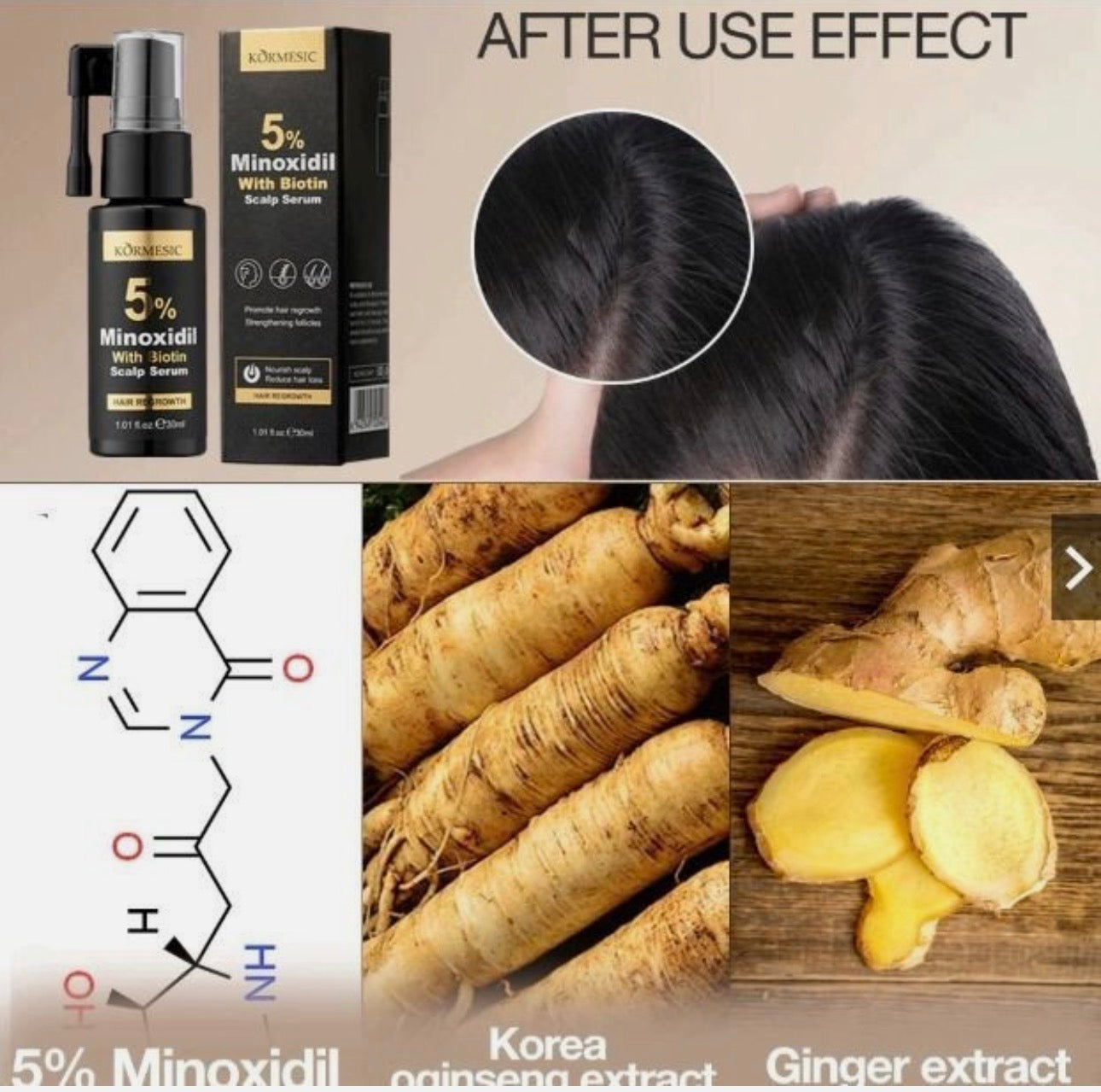Kormesic 5% Minoxidil Biotin Scalp serum 30ml