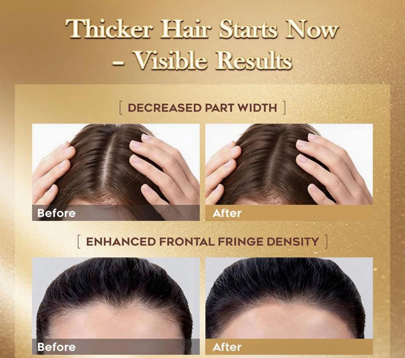 LUMÉI Rosemary Infused Hair Growth Support Serum Caffeine Glycerin Diaminopy-rimidine oxide Advanced Root Renewal Formula 30ml