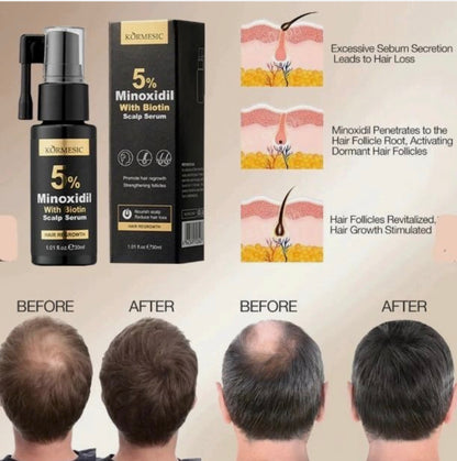 Kormesic 5% Minoxidil Biotin Scalp serum 30ml