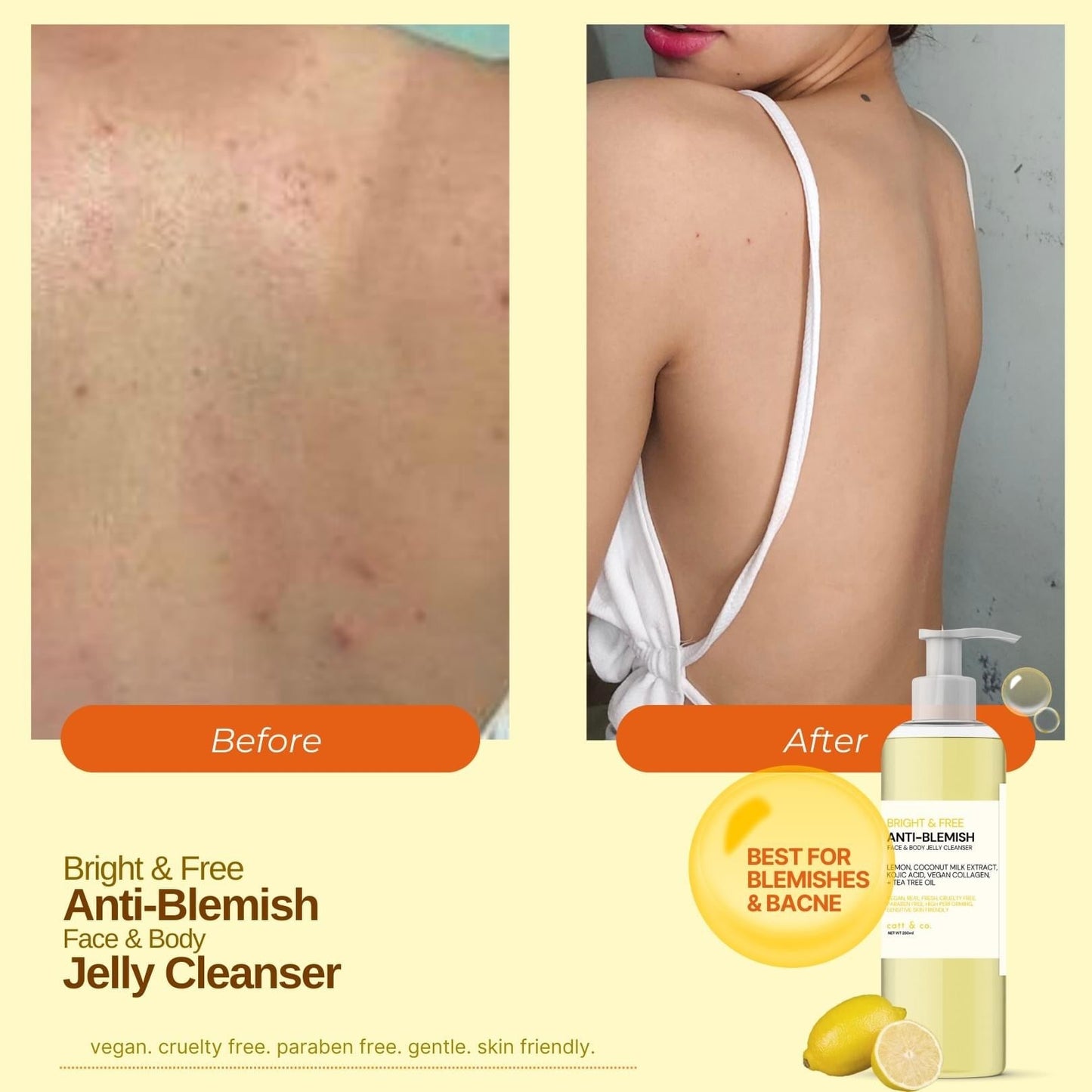 Catt & co. Bright & Free Anti-Blemish Face & Body Jelly Cleanser 250ML