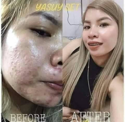Yasuy Skin Rejuvenating set (new pack) - Shop Essential Skin Care Products online | Natural Organic skin care products | ROSYSKIN ESSENTIALS LLC