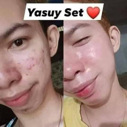 Yasuy Skin Rejuvenating set (new pack) - Shop Essential Skin Care Products online | Natural Organic skin care products | ROSYSKIN ESSENTIALS LLC