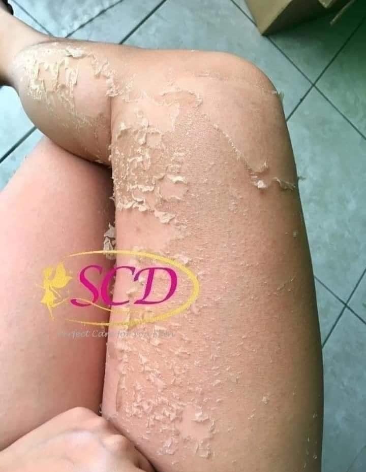 SCD Peeling Skin Lotion 100ml - Shop Essential Skin Care Products online | Natural Organic skin care products | ROSYSKIN ESSENTIALS LLC