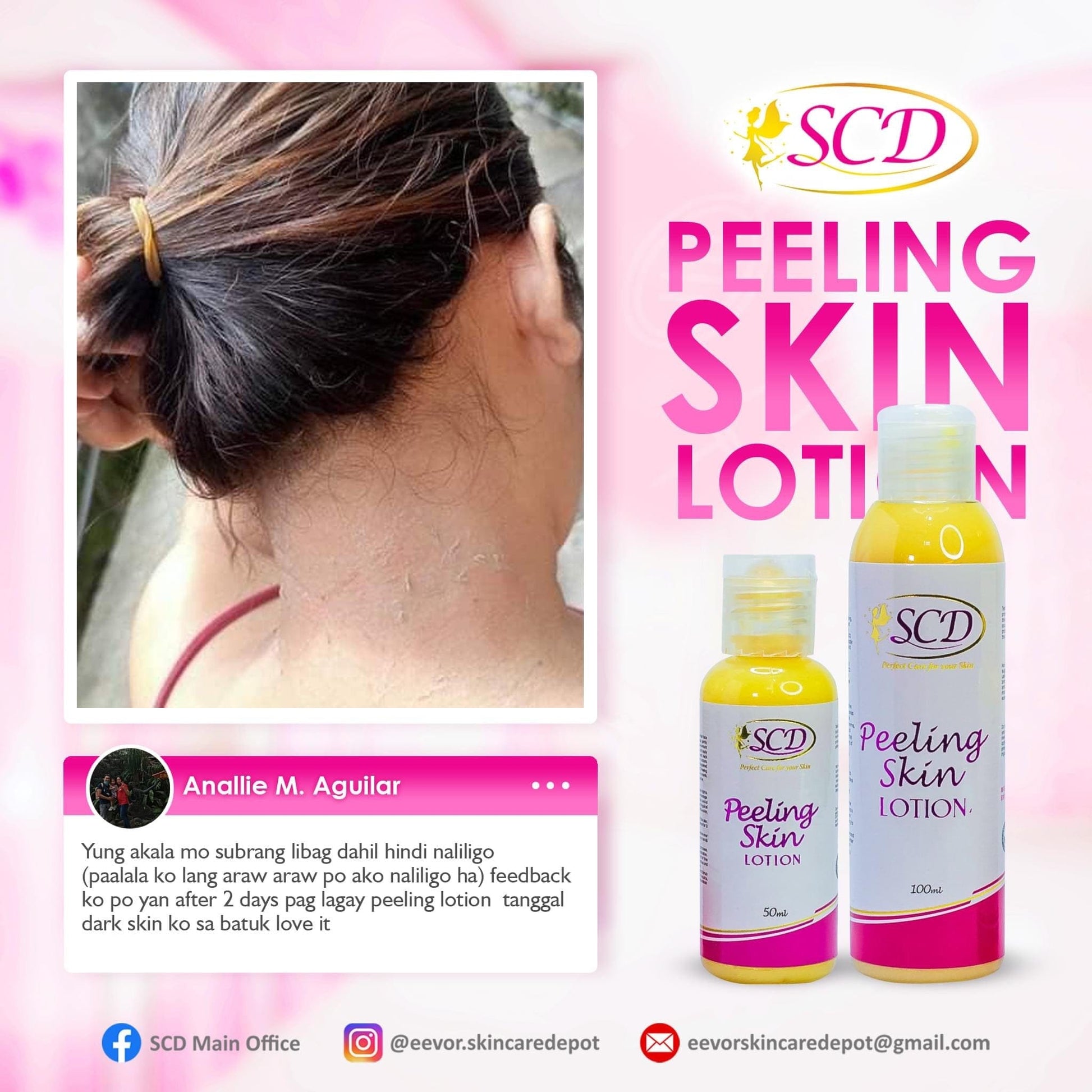 SCD Peeling Skin Lotion 100ml - Shop Essential Skin Care Products online | Natural Organic skin care products | ROSYSKIN ESSENTIALS LLC