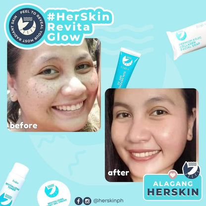 HerSkin Revita-Glow Skin Rescue kit - Shop Essential Skin Care Products online | Natural Organic skin care products | ROSYSKIN ESSENTIALS LLC