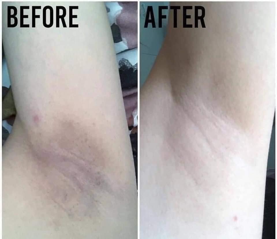 Belo Underarm whitening Cream 40g - Shop Essential Skin Care Products online | Natural Organic skin care products | ROSYSKIN ESSENTIALS LLC