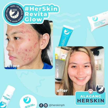 HerSkin Revita-Glow Skin Rescue kit - Shop Essential Skin Care Products online | Natural Organic skin care products | ROSYSKIN ESSENTIALS LLC