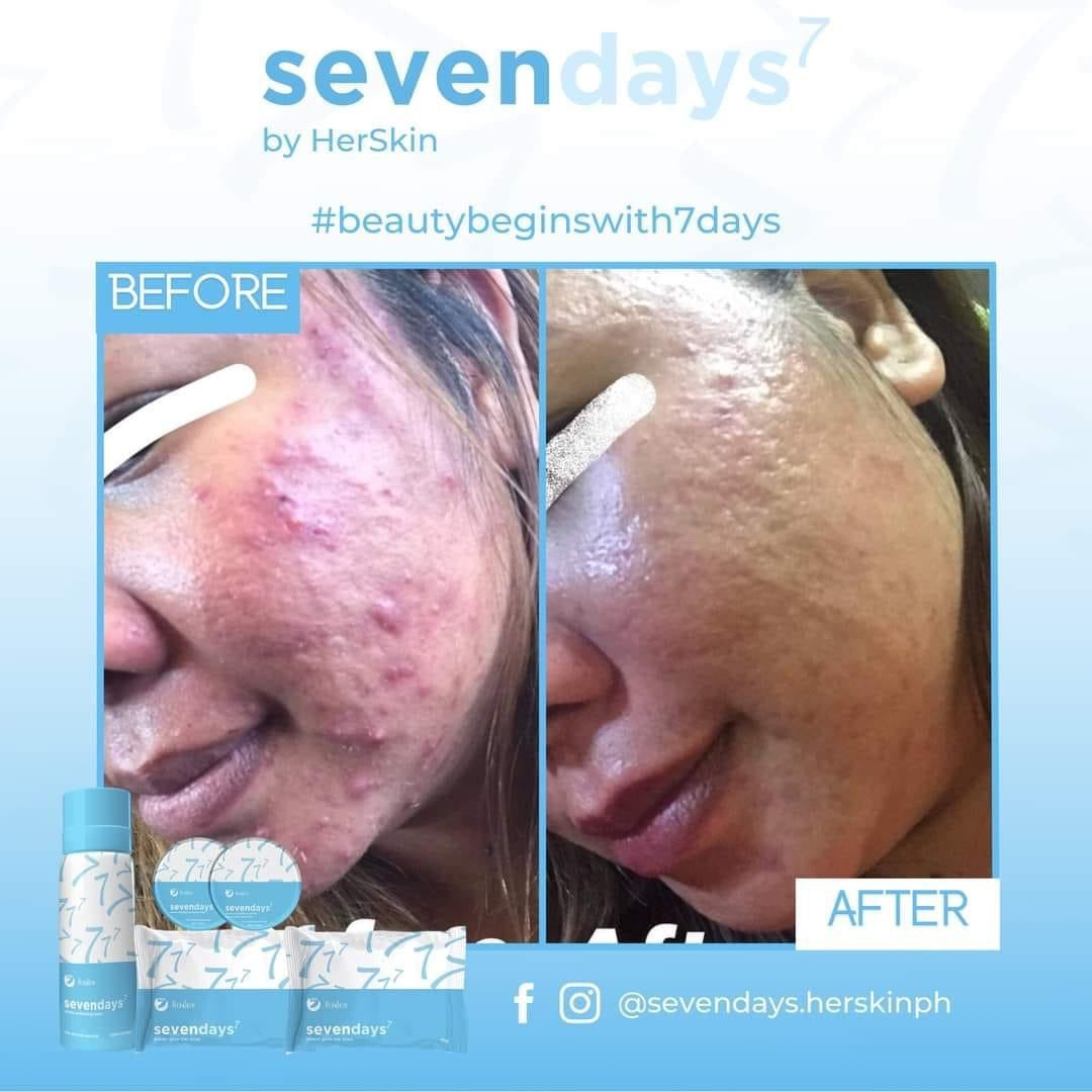 HerSkin Sevendays Facial Set - Shop Essential Skin Care Products online | Natural Organic skin care products | ROSYSKIN ESSENTIALS LLC