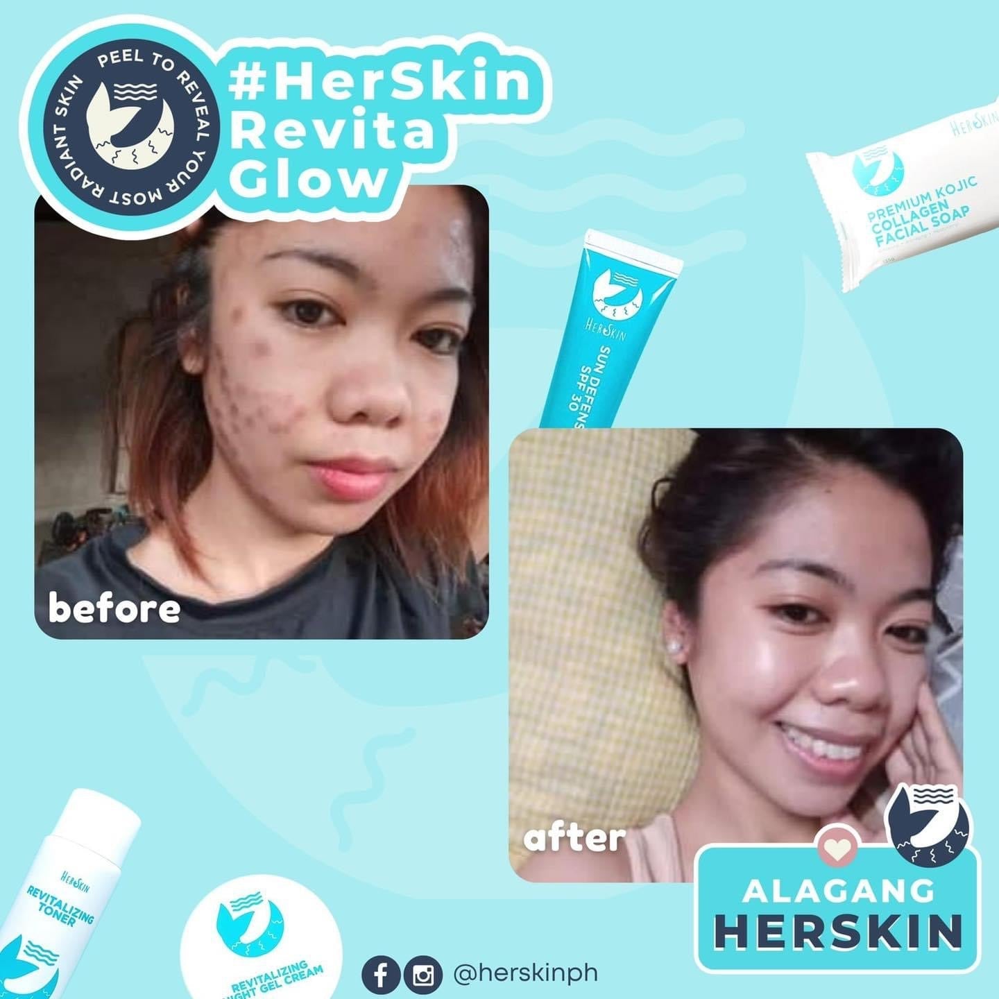 HerSkin Revita-Glow Skin Rescue kit - Shop Essential Skin Care Products online | Natural Organic skin care products | ROSYSKIN ESSENTIALS LLC