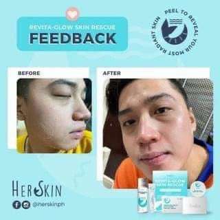 HerSkin Revita-Glow Skin Rescue kit - Shop Essential Skin Care Products online | Natural Organic skin care products | ROSYSKIN ESSENTIALS LLC